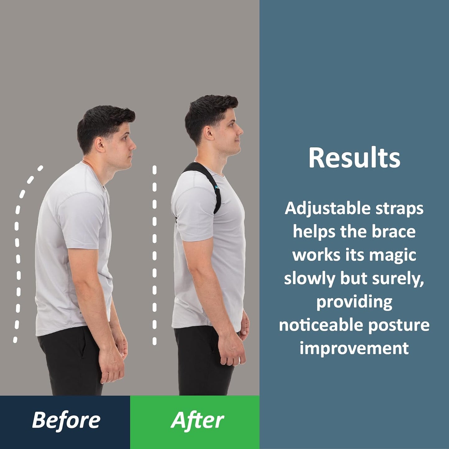 Posture Corrector for Men and Women, Back Brace Straightener | Breathable Adjustable Posture Brace, Shoulder Brace Straps and Upper Back Support for Neck Hump, Hunchback, Clavicle Pain